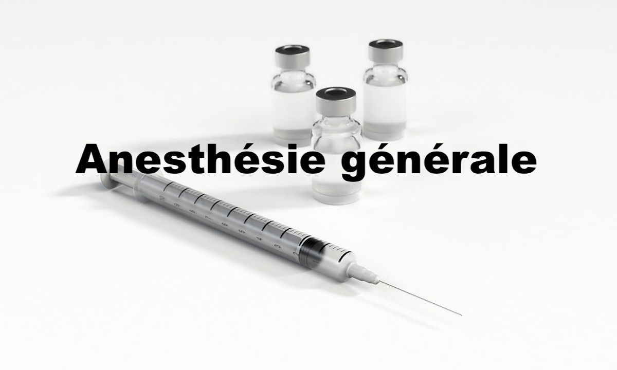Anesthésie générale